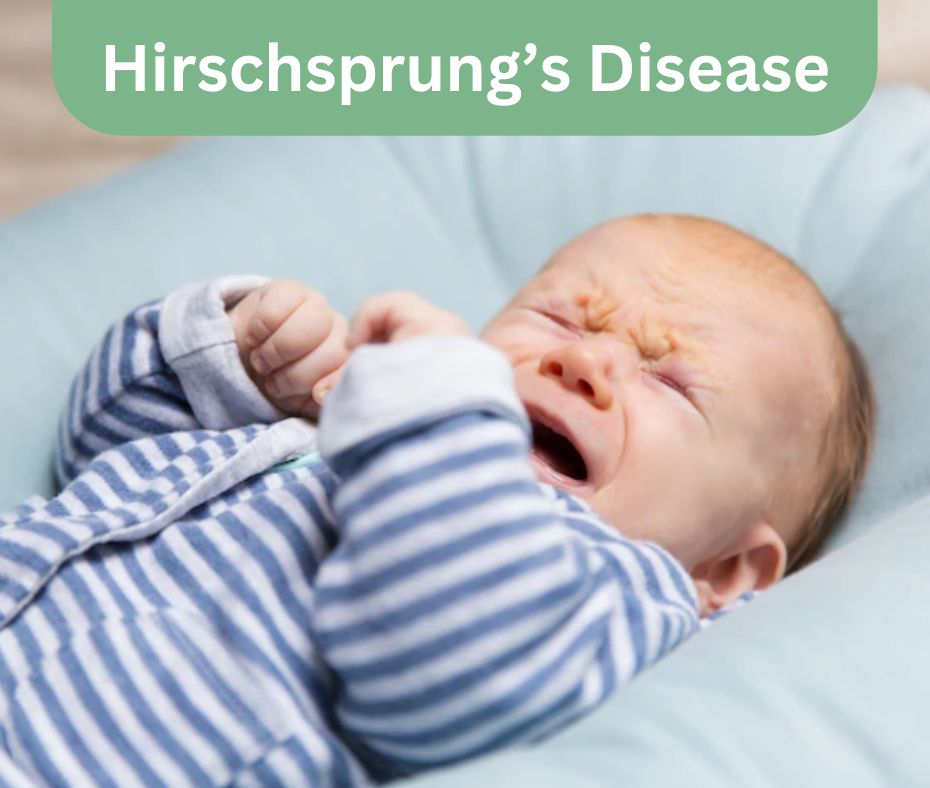 Pediatric Hirschsprung's Disease Treatment In Pune | Dr. Geeta Kekre