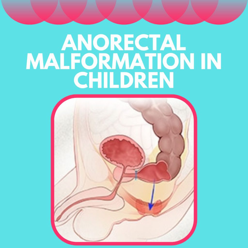 Anorectal Malformations Dr Geeta Kekre 9282