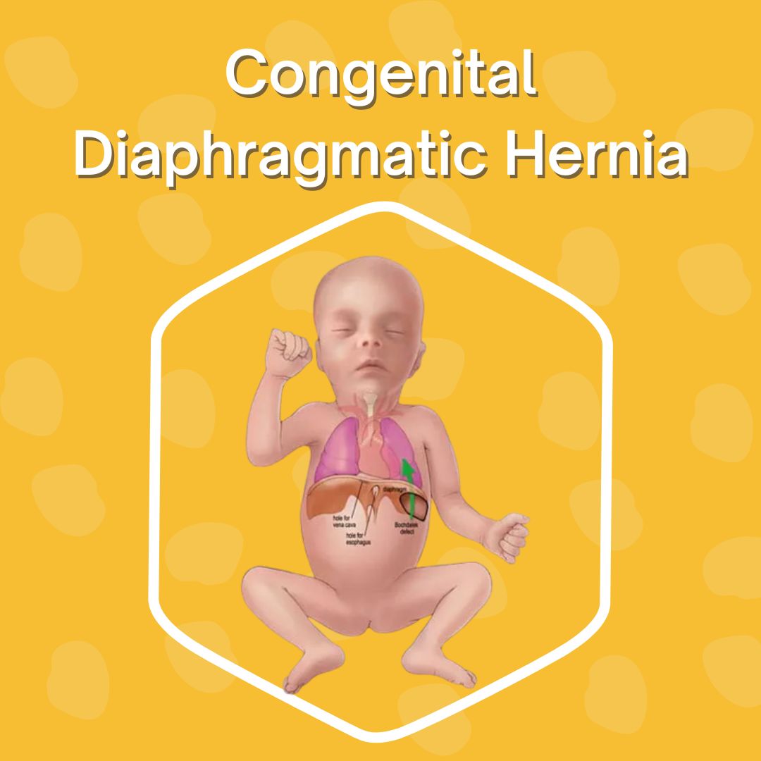 Congenital Diaphragmatic Hernia | Dr. Geeta Kekre