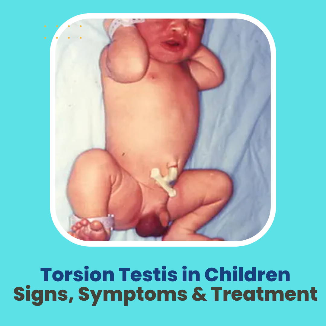 Torsion Testies in Children | Dr. Geeta Kekre