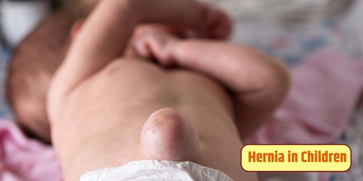 hernia in children - how it is different form adults