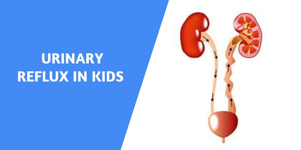 urinary reflux in kids