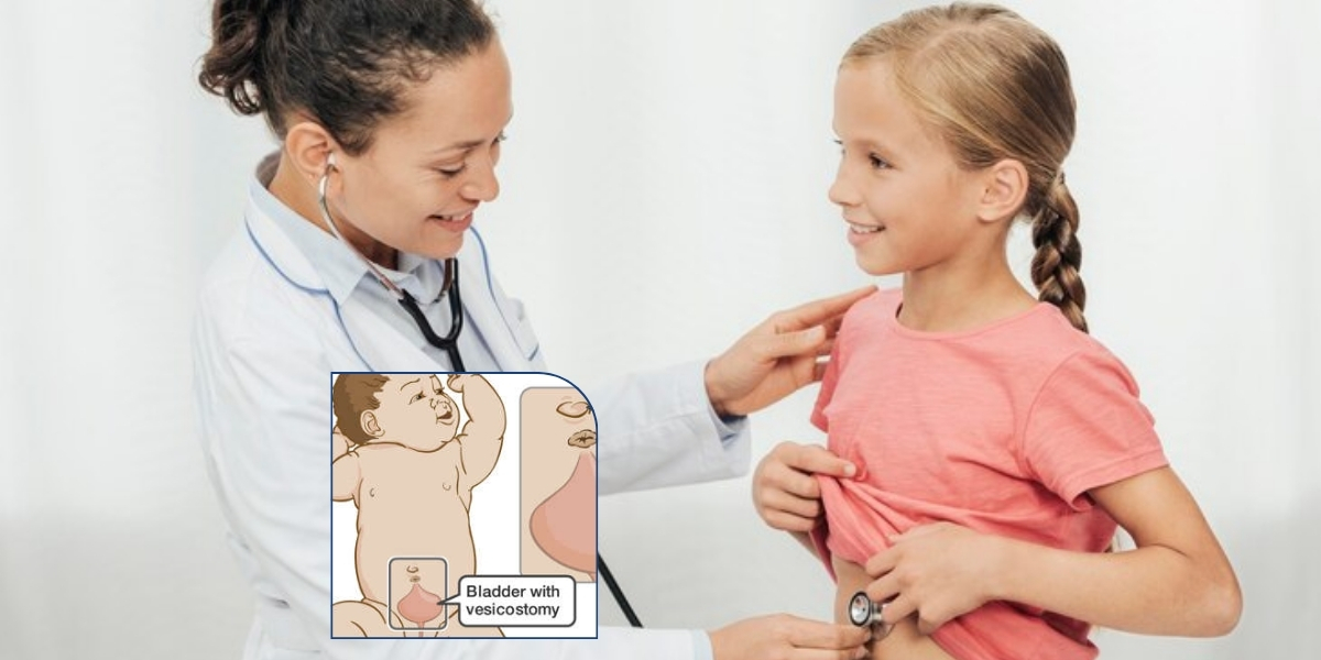 Vesicostomy For Children