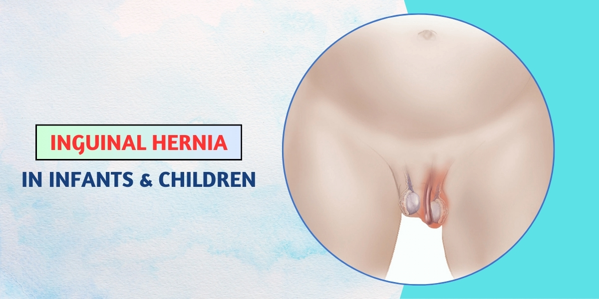 inguinal hernia in children