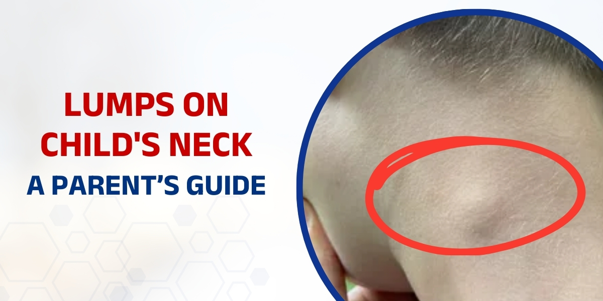 lumps on a child's neck