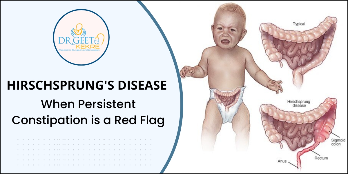 Hirschsprung's disease Treatment