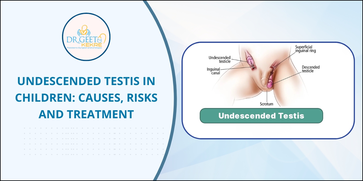 Undescended Testis in Children